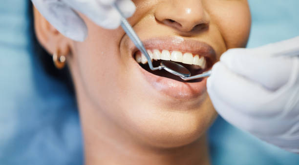 Best Emergency Gum Treatment in Gaithersburg, MD