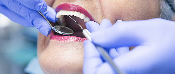 Best Emergency Tooth Extraction in Gaithersburg, MD